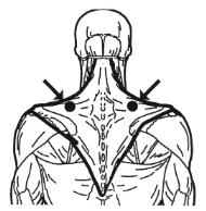 Triggerpunkte im Schulter-Nacken-Bereich